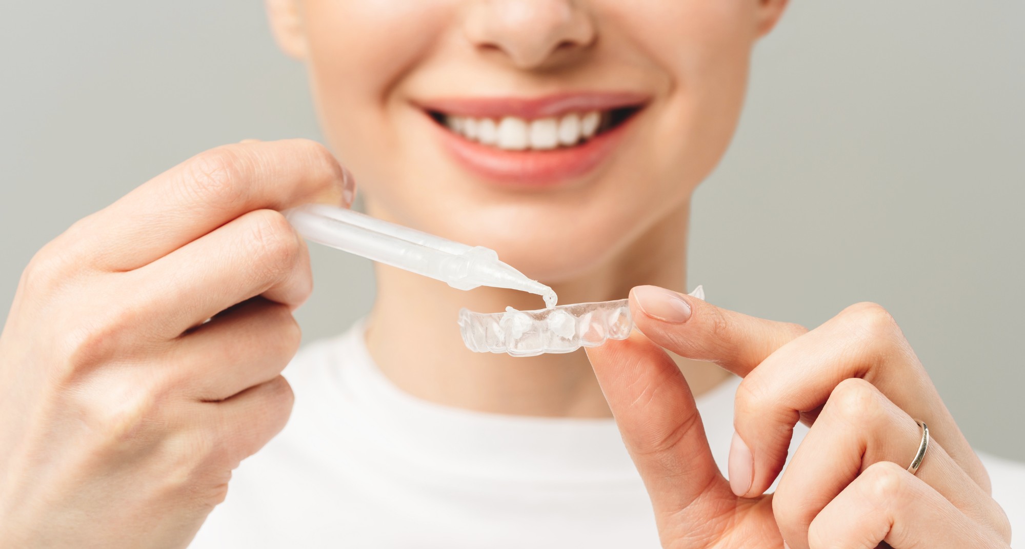 Ho i denti sensibili: posso fare lo sbiancamento?